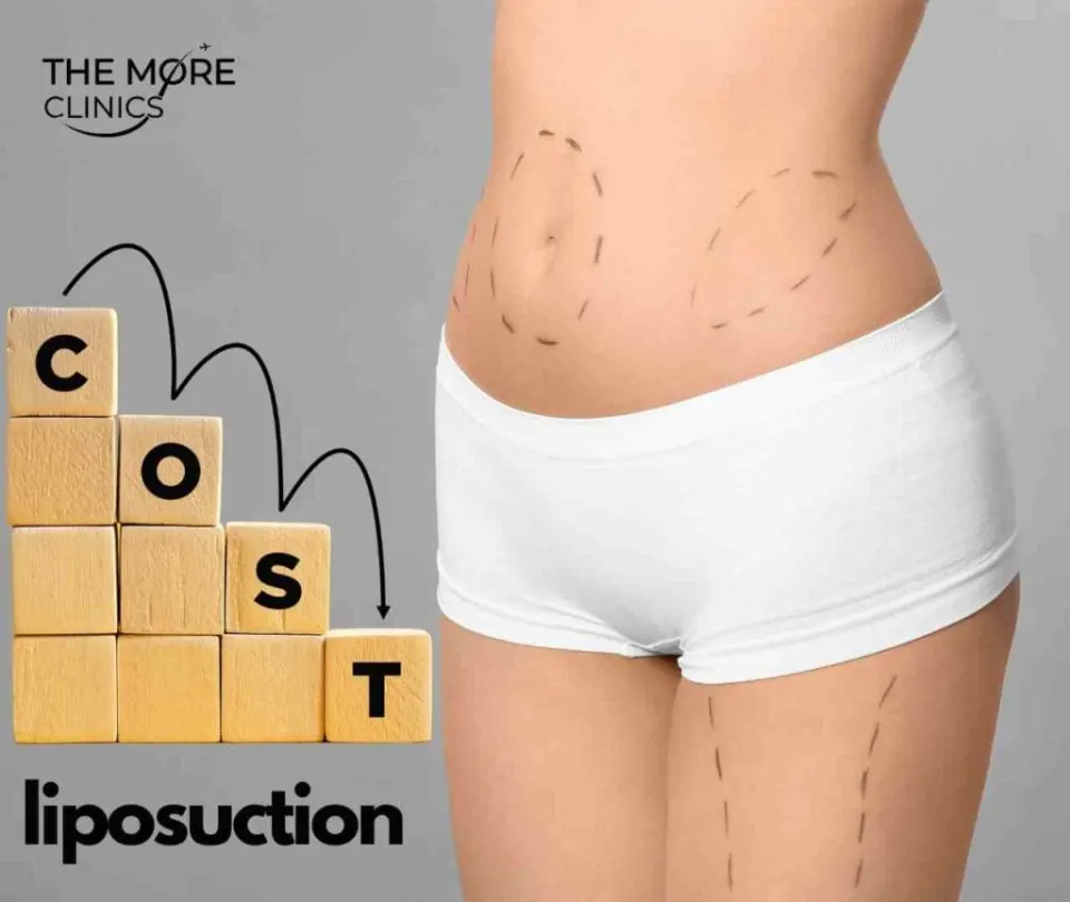 how much does liposuction cost turkey