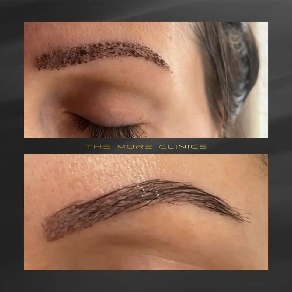 Hair before & after 37