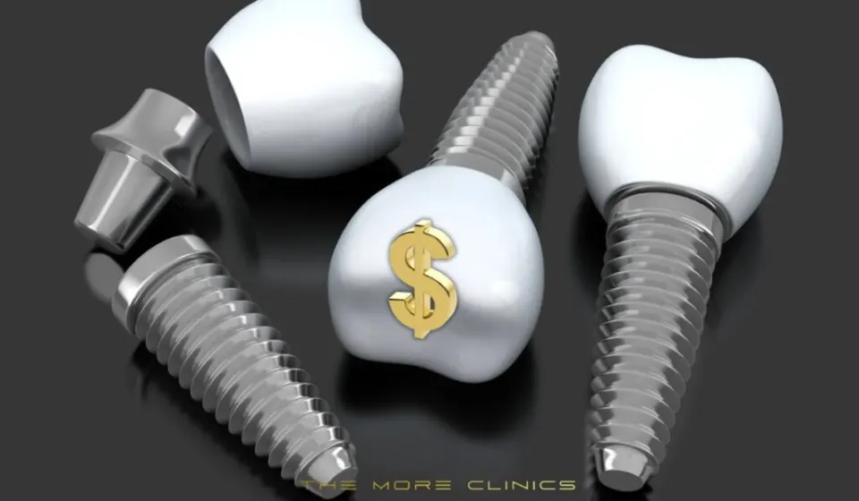 Antalya Best Dental Implants