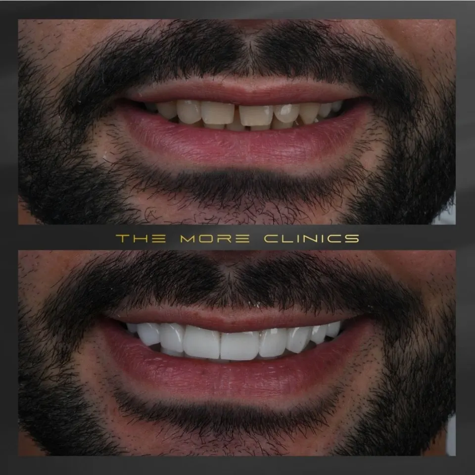 Dental before & after 26