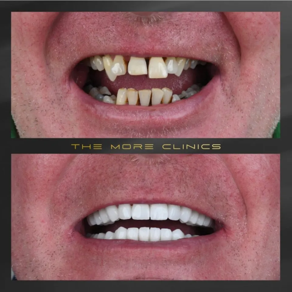 Dental before & after 12