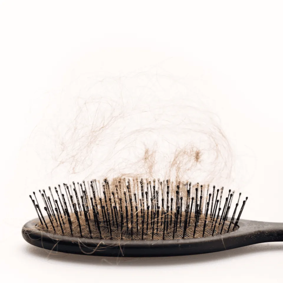 Antalya Hair Transplant