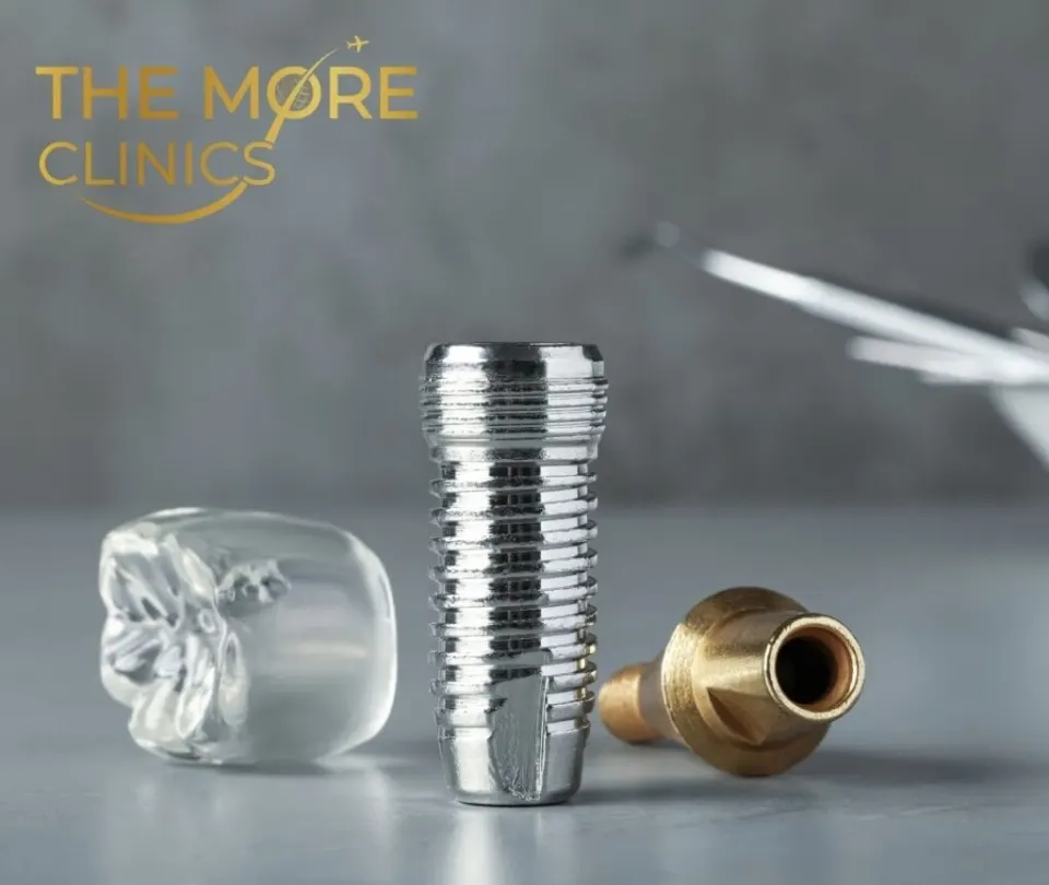 how long does an implant last