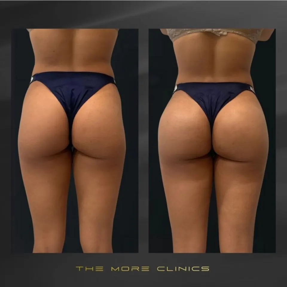 Antalya Plastic Surgery