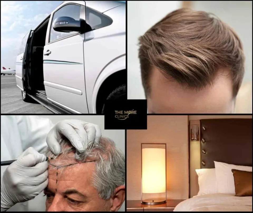 all inclusive hair transplant package turkey antalya