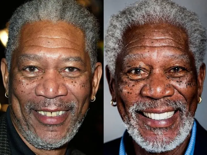 Morgan Freeman Teeth Before and After