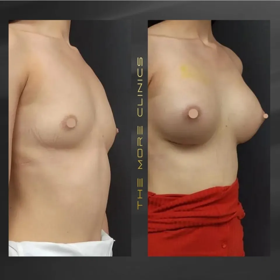 Aesthetic-surgery results 2