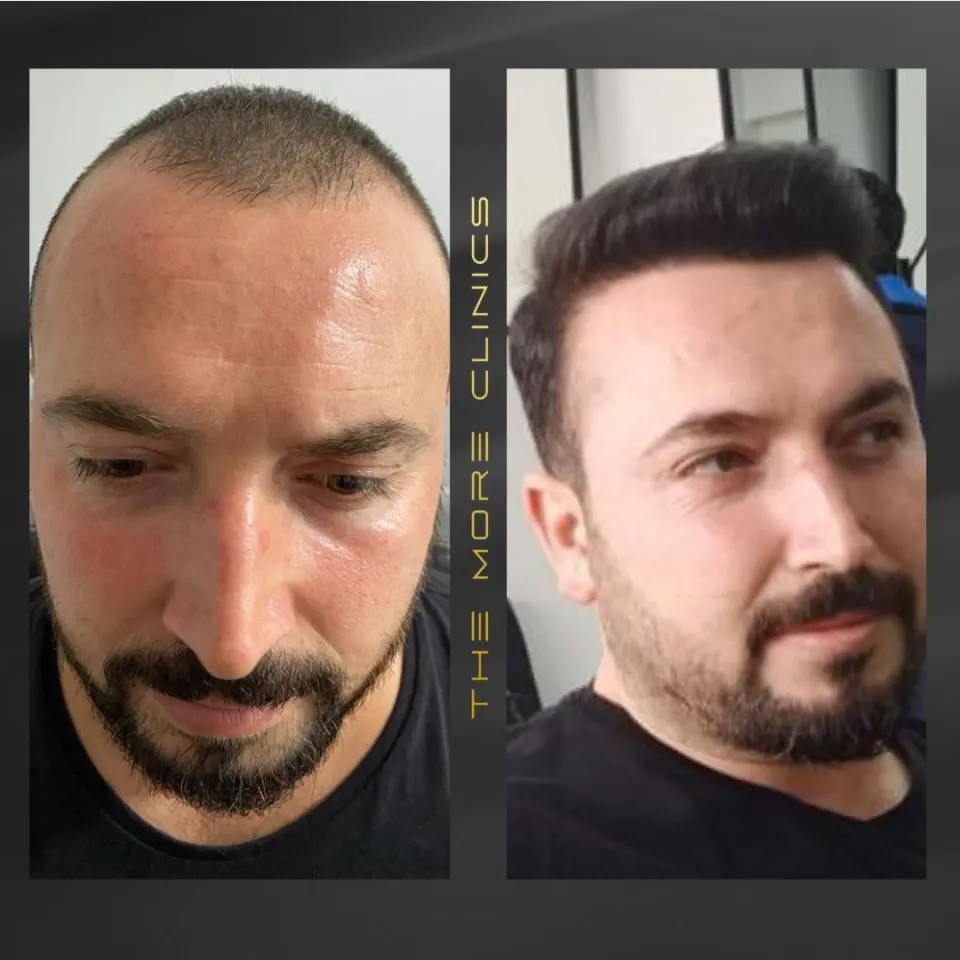 Hair before & after 19
