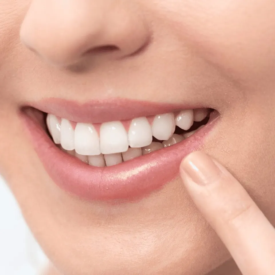Antalya Smile Makeover