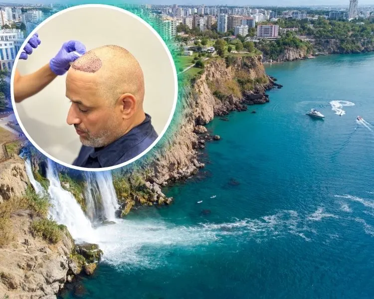Antalya hair transplant