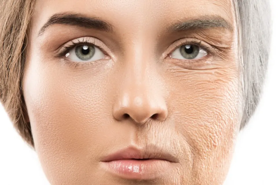 Lifting du visage avant et après
