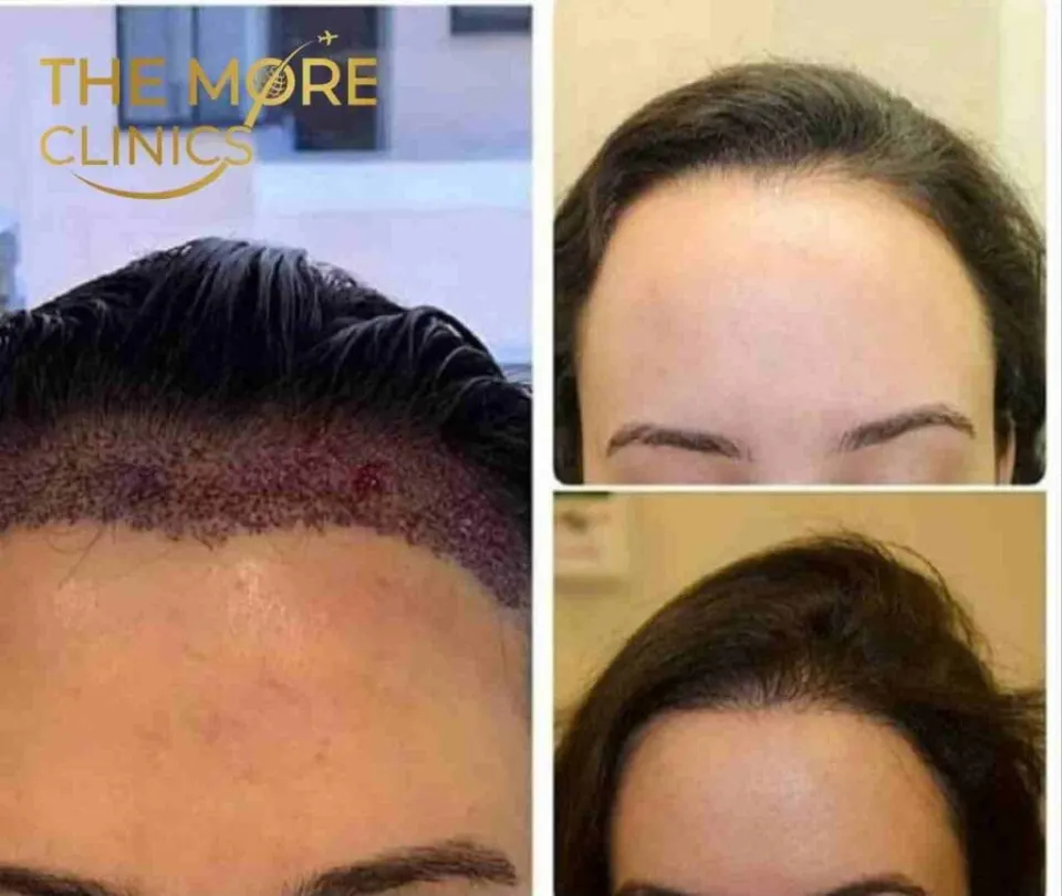 Haare vorher & nachher 36