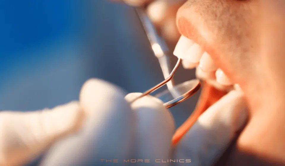 Antalya dental emergency