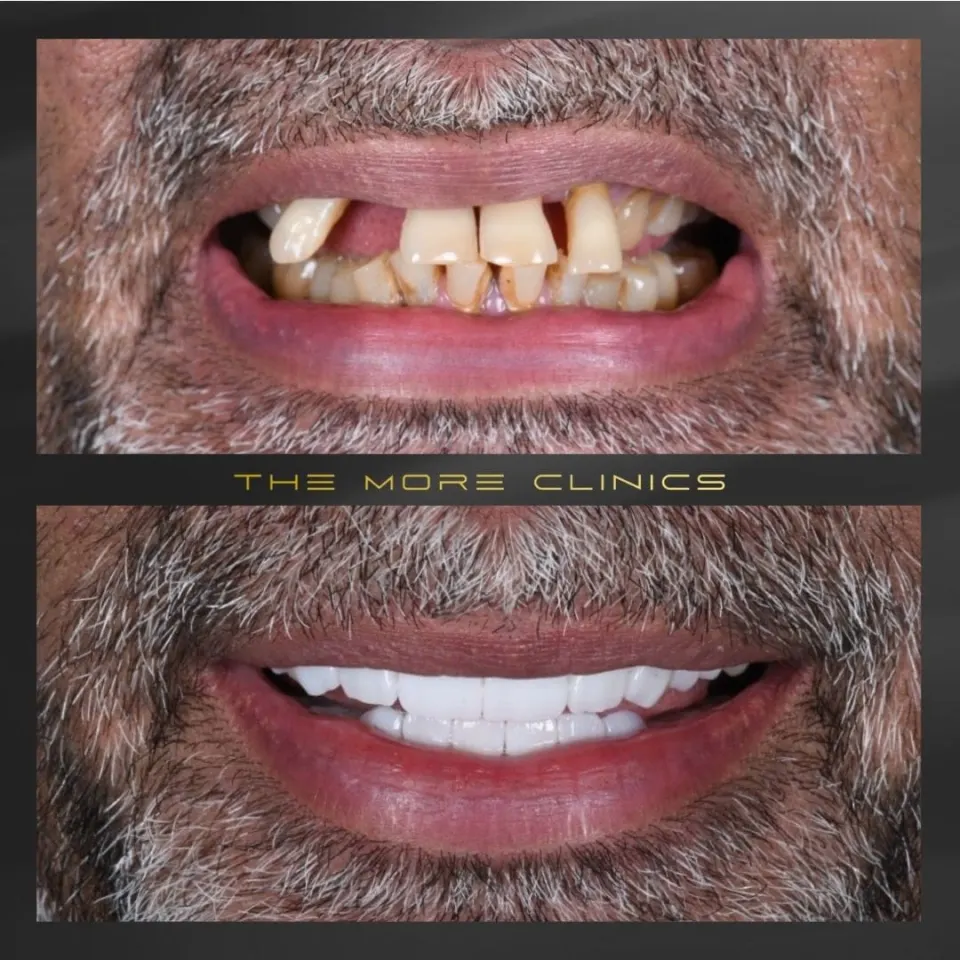 Dental before & after 20