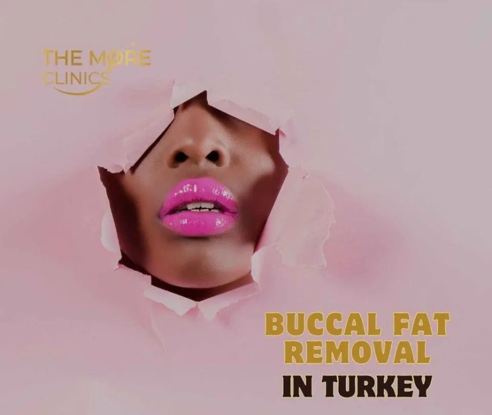 cost of buccal fat removal turkey