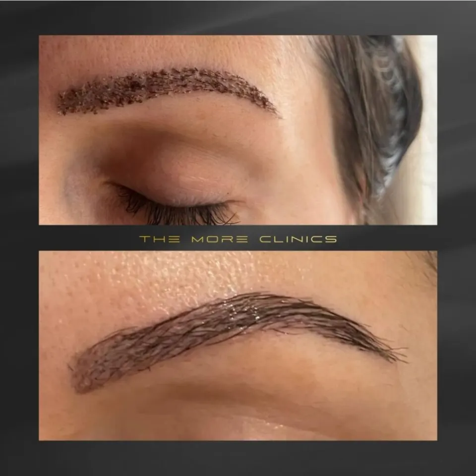 Haare vorher & nachher 42