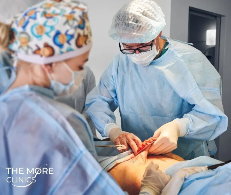Fettabsaugung Türkei Klinik