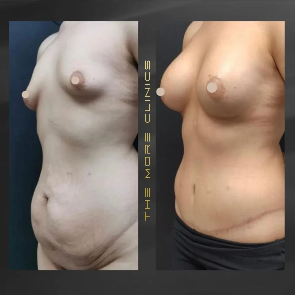 Aesthetic-surgery results 3