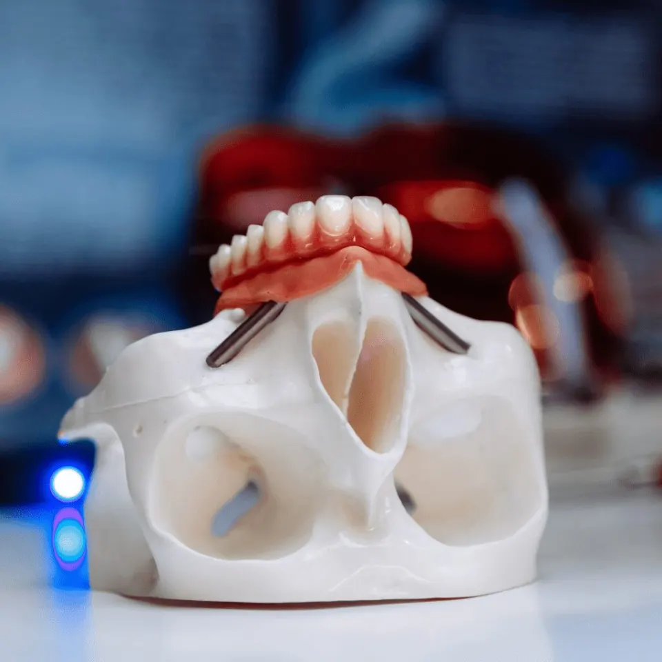 Antalya Oral and Maxillofacial Surgeons