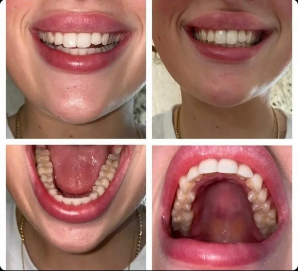 dental-treatment-turkey