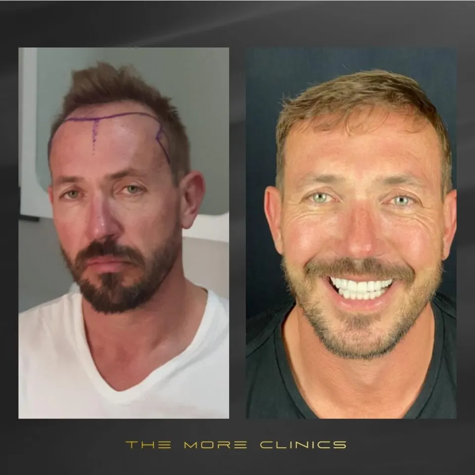Hair before & after 25