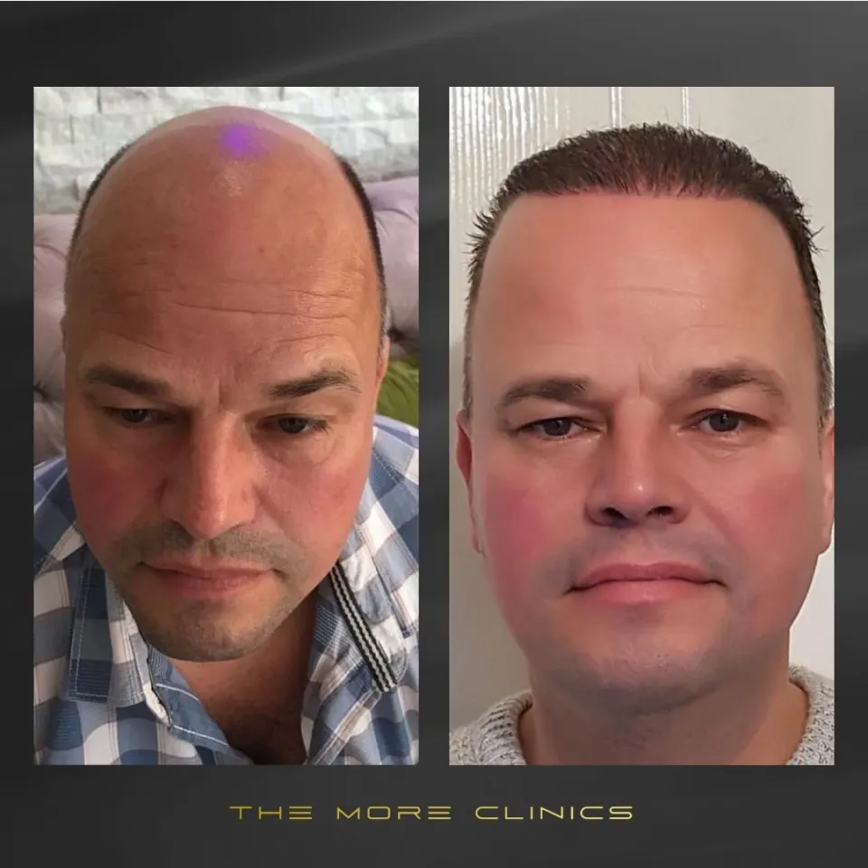 Hair before & after 26