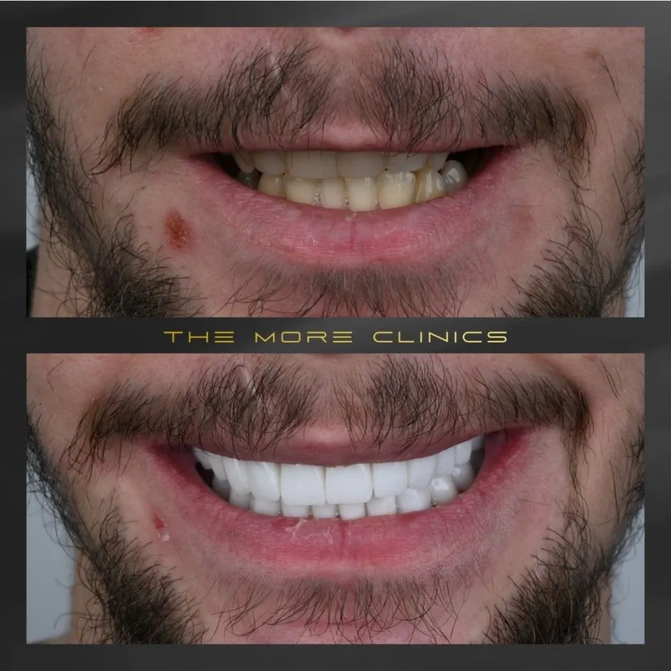 Dental before & after 40