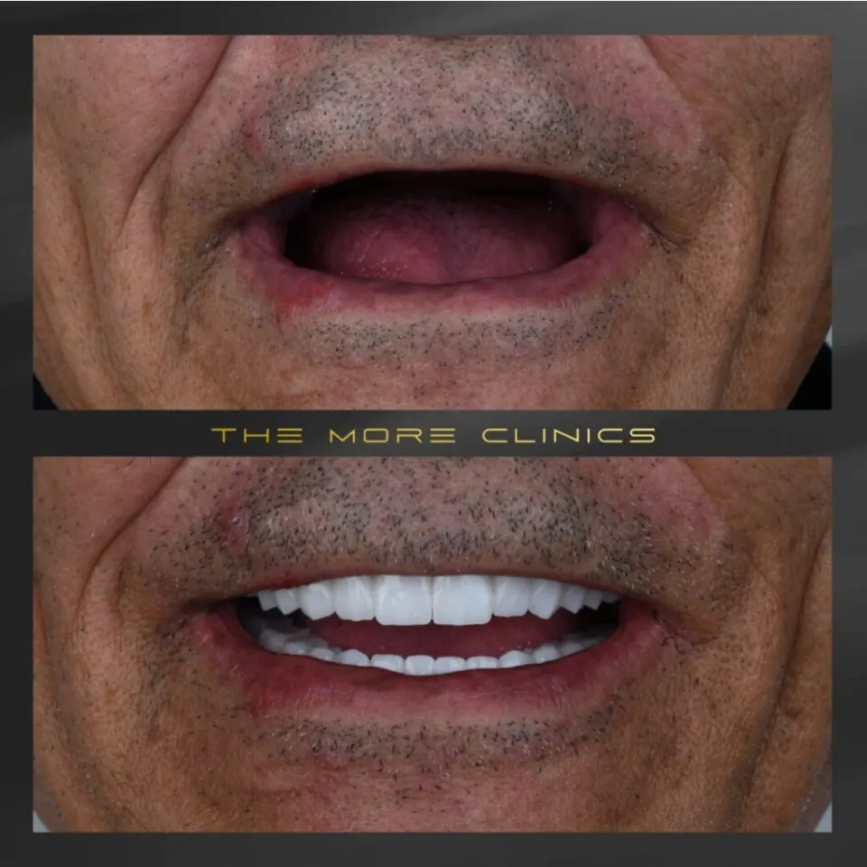 Dental before & after 8