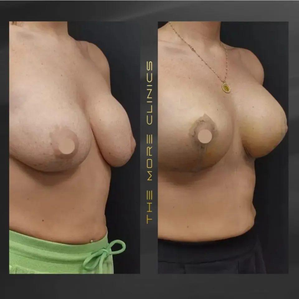 Aesthetic-surgery results 4