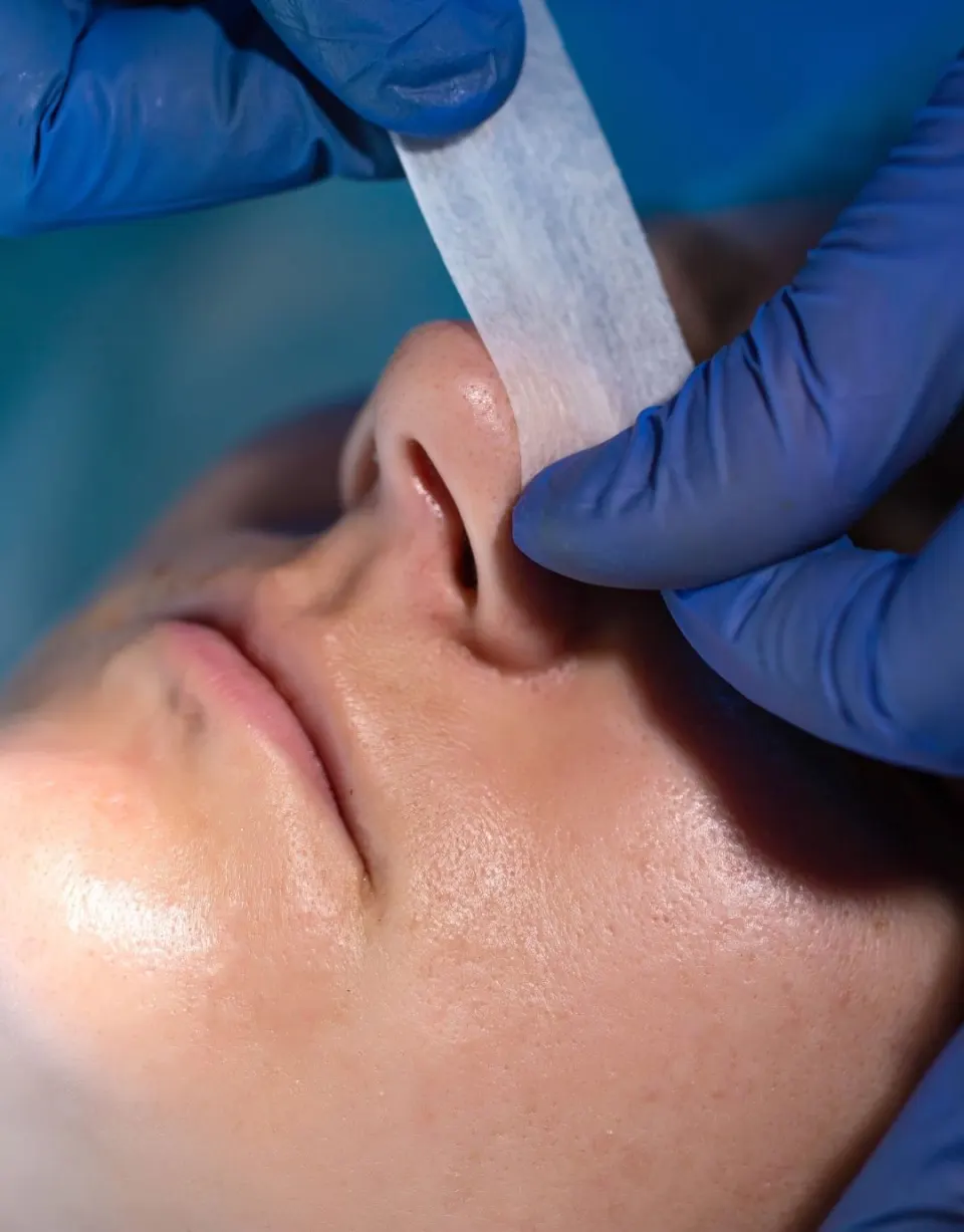 rinoplastia costes Turquía Antalya