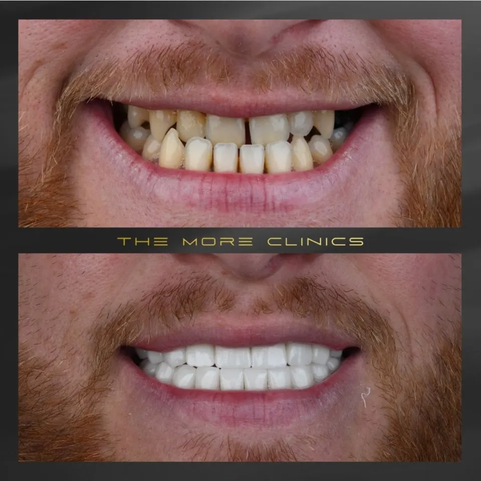 Dental before & after 22