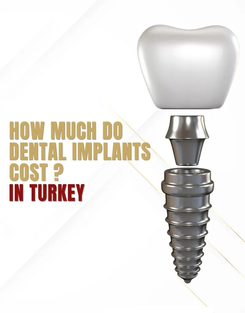 Precio Implantes Dentales Antalya Turquía