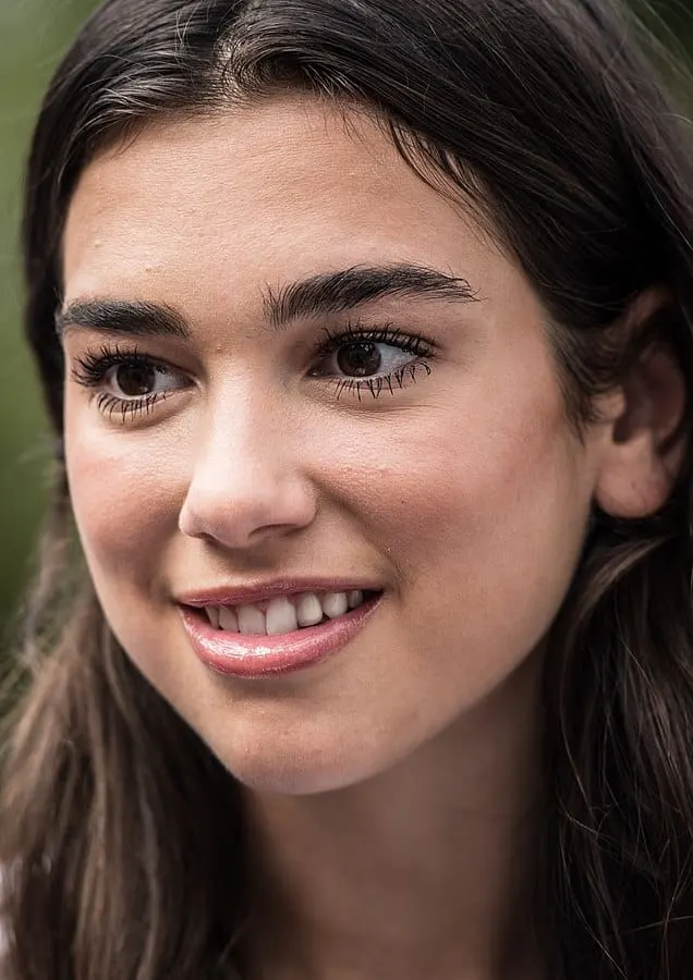 Dua Lipa Teeth Before celebrity veneers