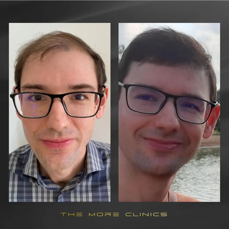 Hair before & after 28