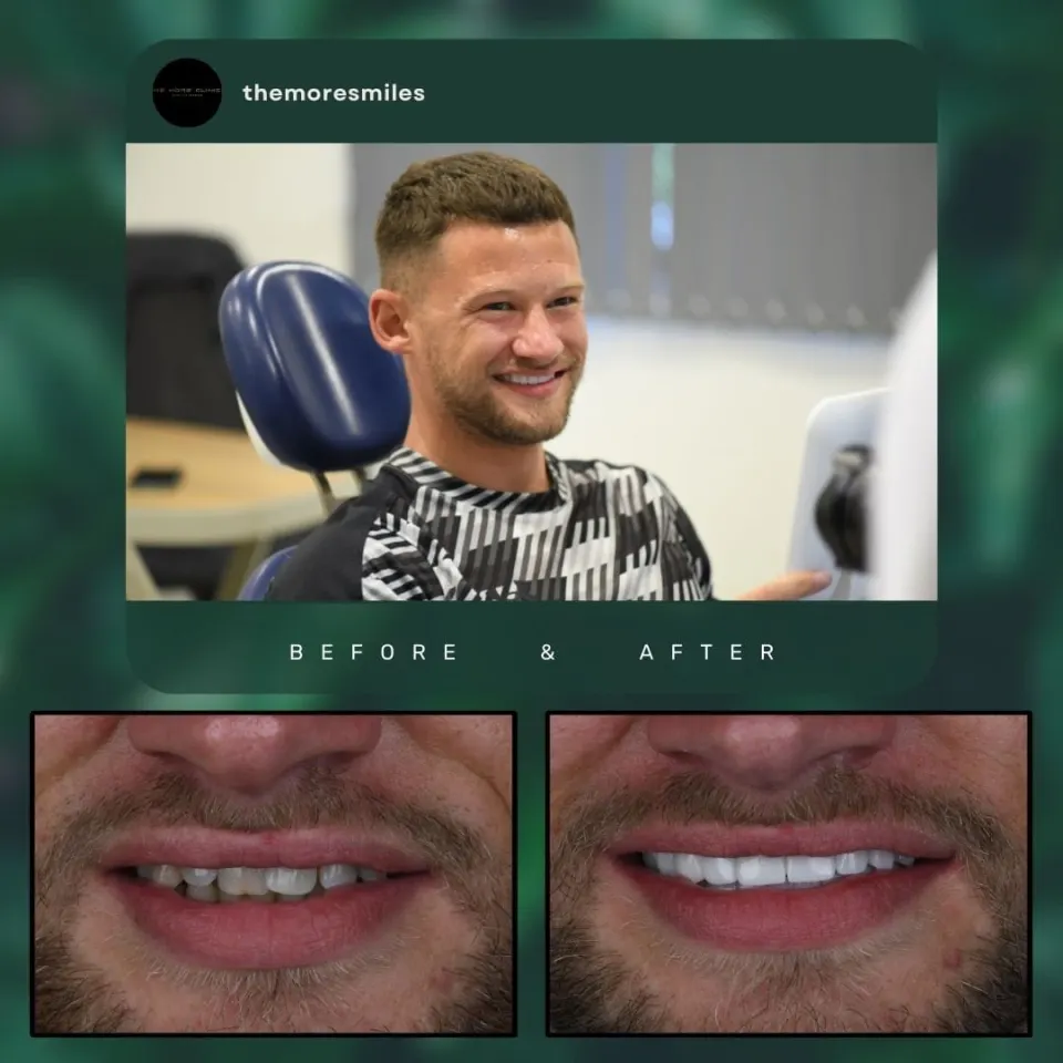 Dental before & after 48
