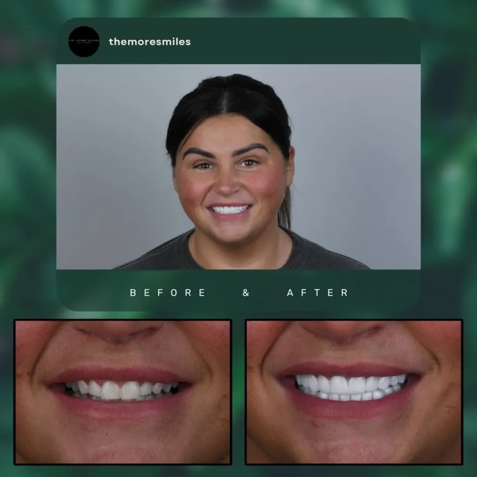 Dental before & after 49