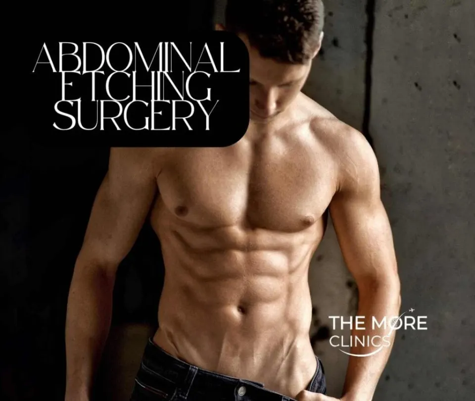 abdominal etching surgery cost