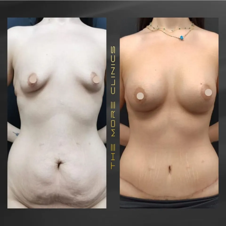 Aesthetic-surgery results 1