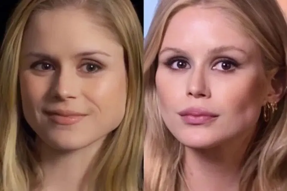 erin moriarty before and after cosmetic surgery facial