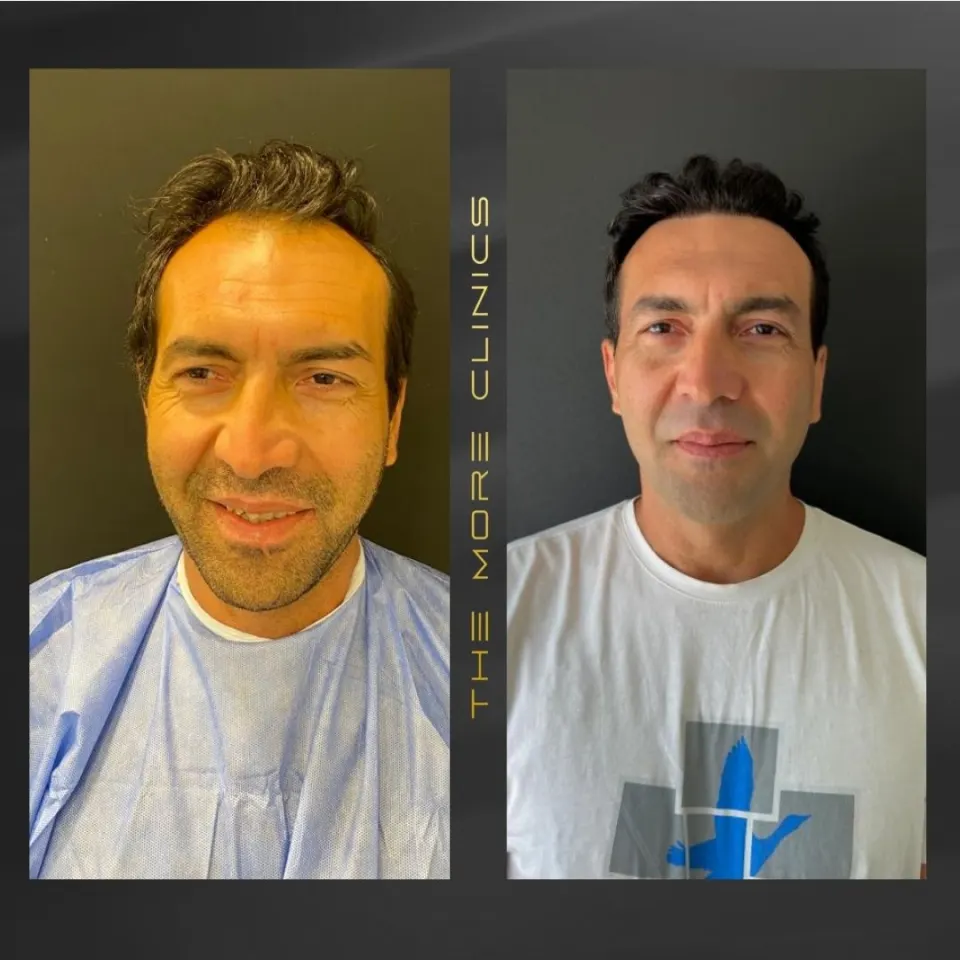 Hair before & after 20