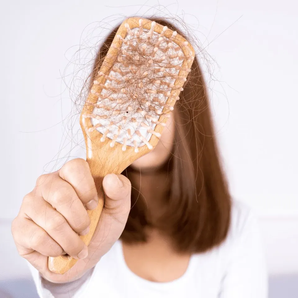alopecia areata symptoms
