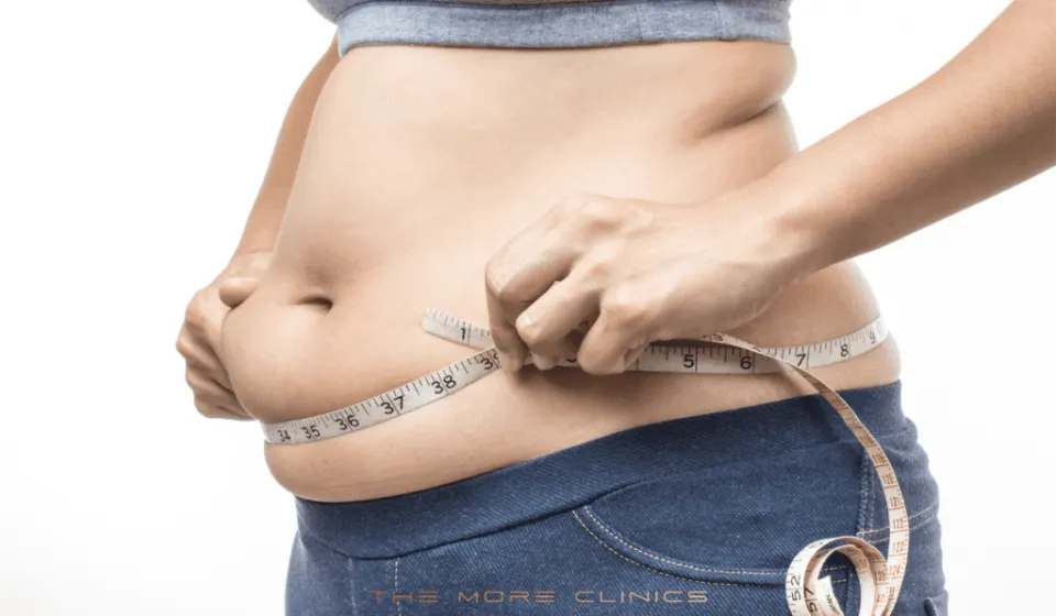 Antalya gastric sleeve
