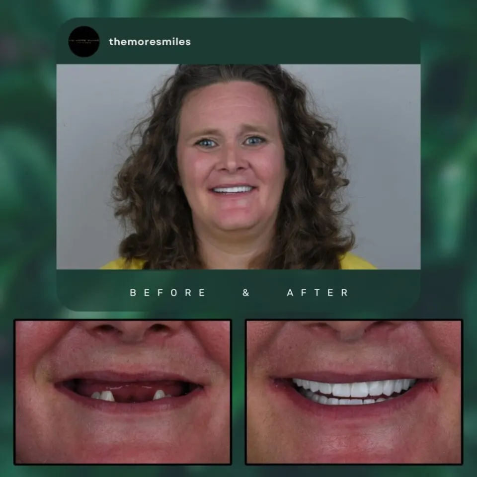 Dental results 2
