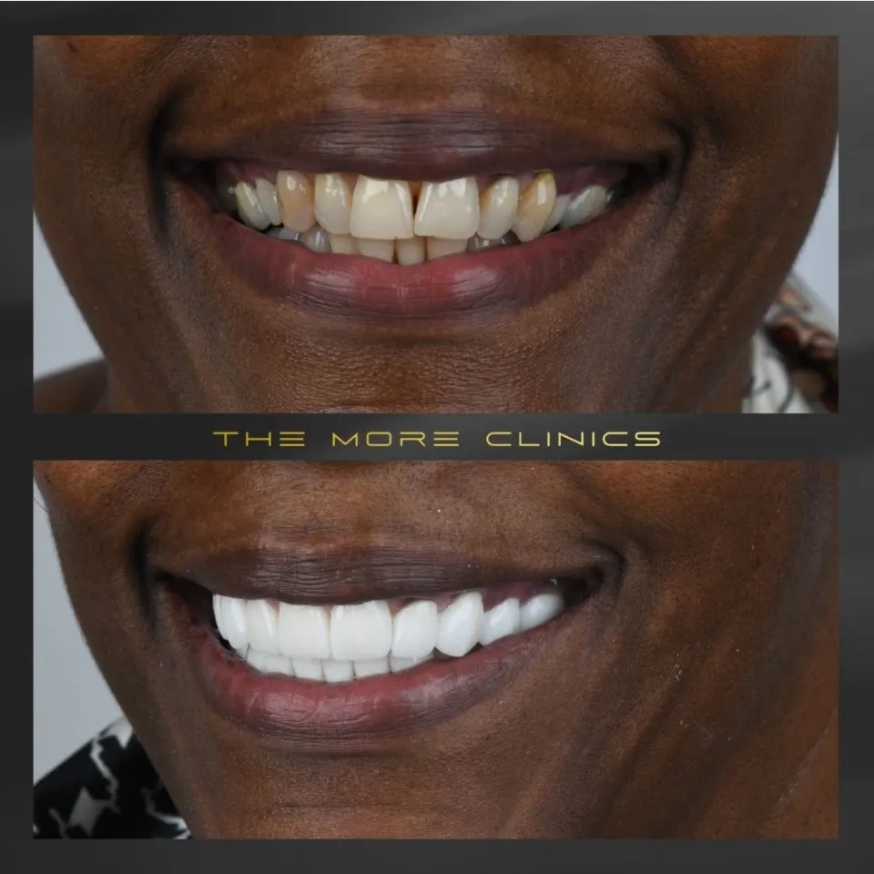 Dental before & after 28