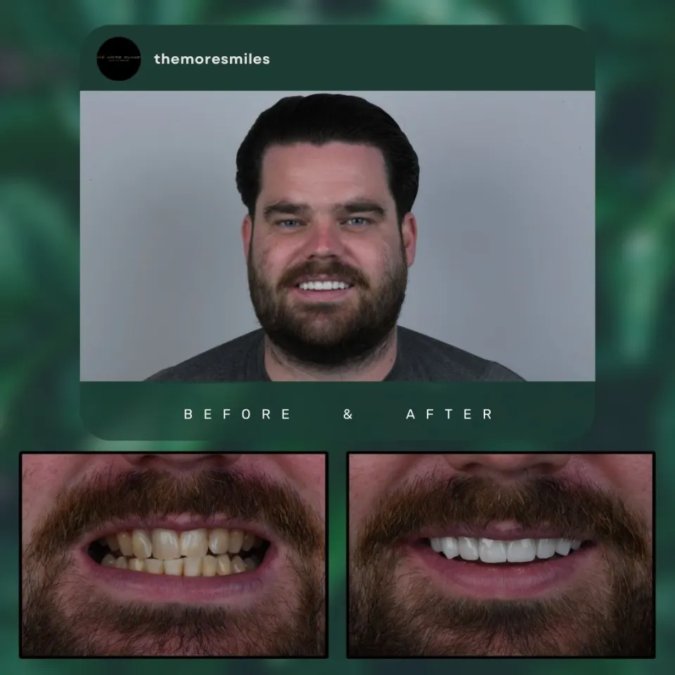 Dental before & after 50