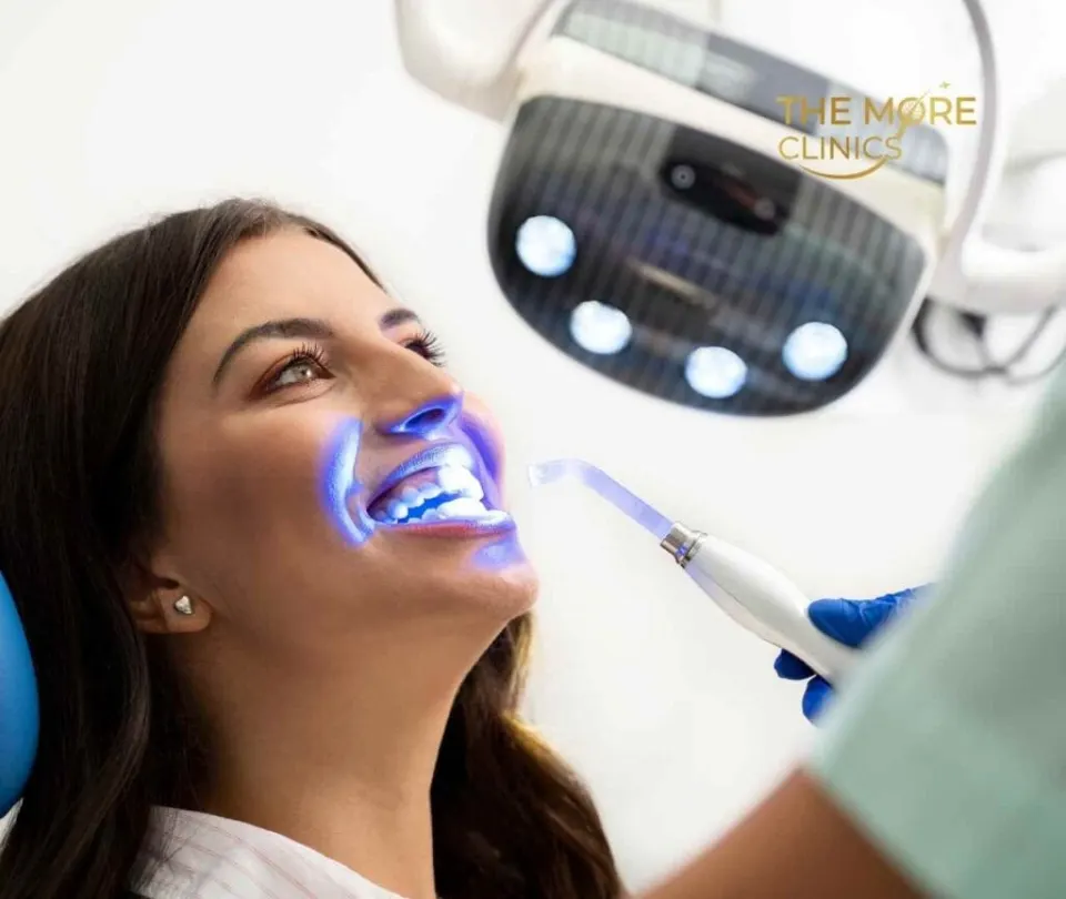 laser teeth whitening antalya turkey