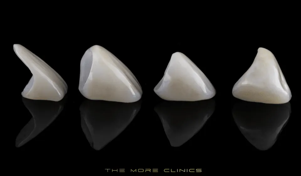 zirconium crown smile makeover zirconia