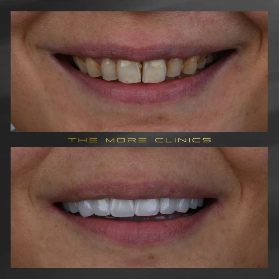 Dental before & after 39