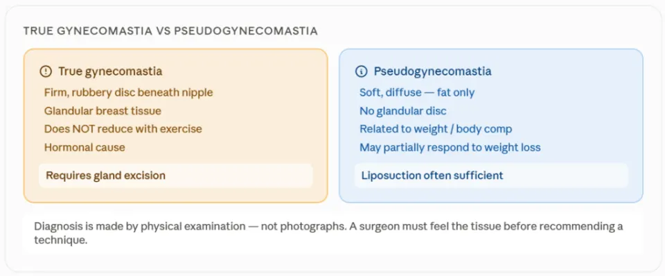 gynecomastia vs pseudogynecomastia