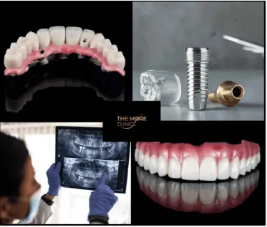 dental implants Hungary Helvetic Clinics